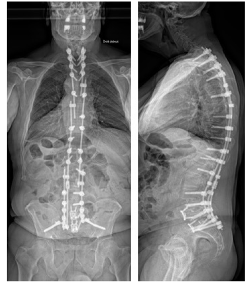 post-op-2
