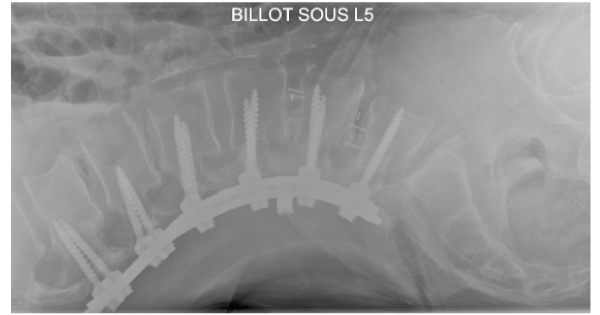 pre-op-2