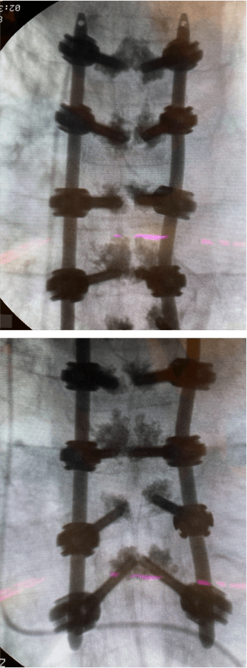 intraop15 marco grosso pre operation representation